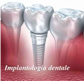 Rigenerazione ossea in implantologia (NDMagazine Luglio/Agosto 2023)